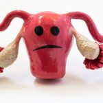 Women's Health Uterine Fibroids