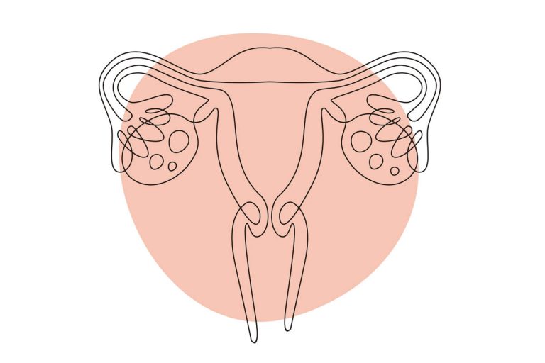 Vaginal Atrophy